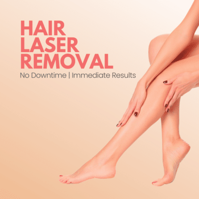 laser hair removal in delhi